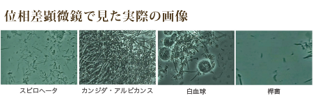 位相差顕微鏡