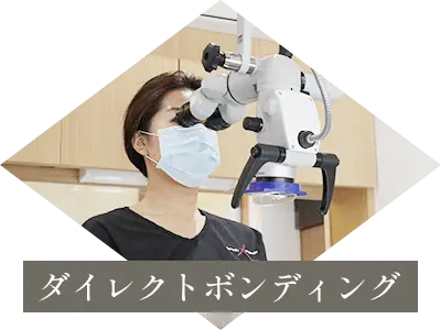 ダイレクトボンディング