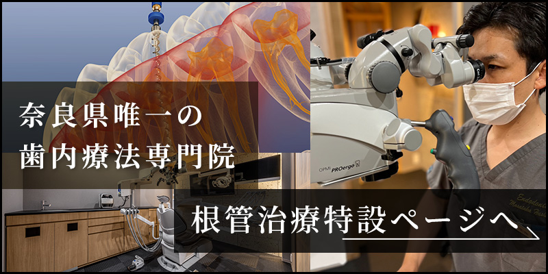 根管治療LP